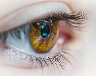 レーシック(視力回復)